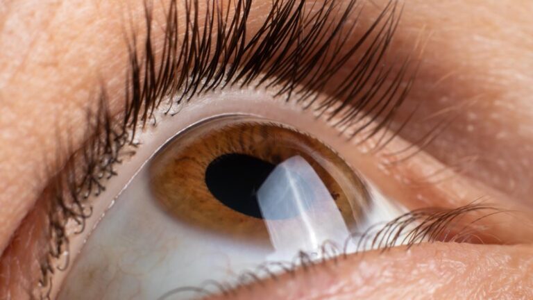 Eye donation and corneal transplant